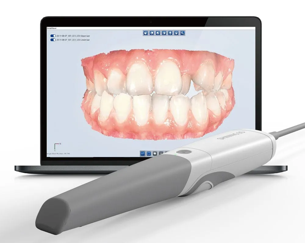 3D Intraoral Dental Scanner for Precision Dentistry at Nijanand Dental Clinic