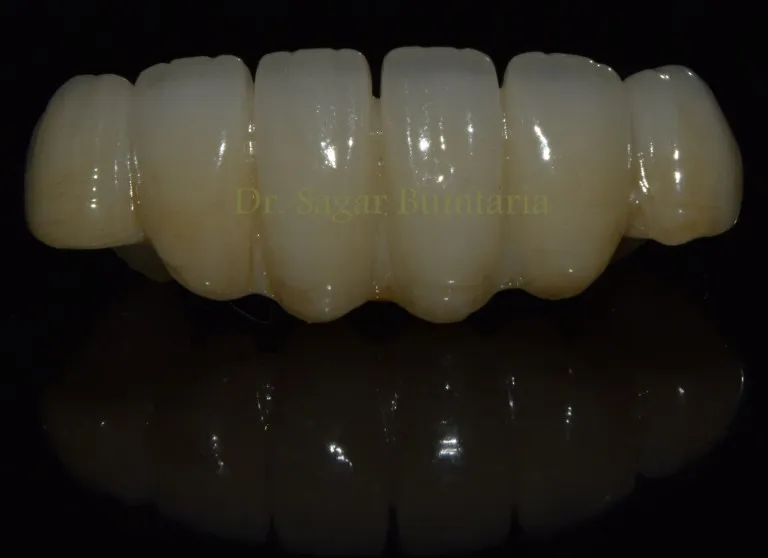 Advanced dental care setup at Nijanand Dental Clinic Jamnagar
