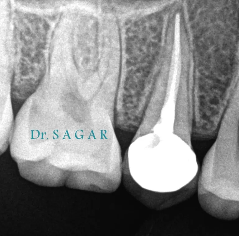 Advanced dental care treatment by dental specialist in Jamnagar
