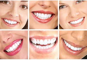 Cosmetic Smile Designing Treatment in Jamnagar