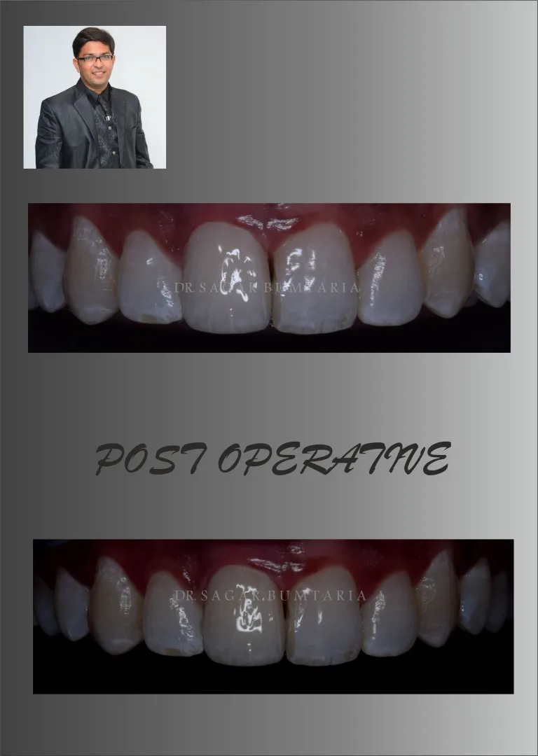 Dental care and cosmetic treatment result in Jamnagar