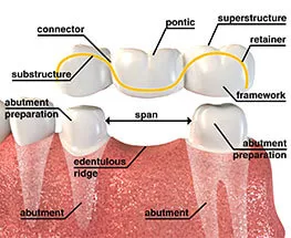 Patient Receiving Dental Crown Procedure in Jamnagar Clinic