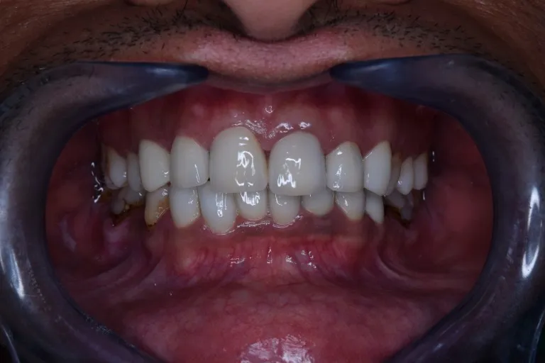 Dentist consulting patient at dental clinic in Jamnagar