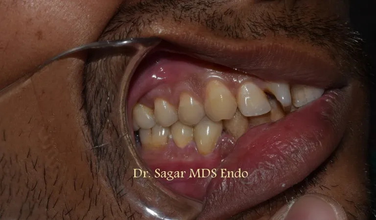 Dentist performing oral examination at clinic in Jamnagar