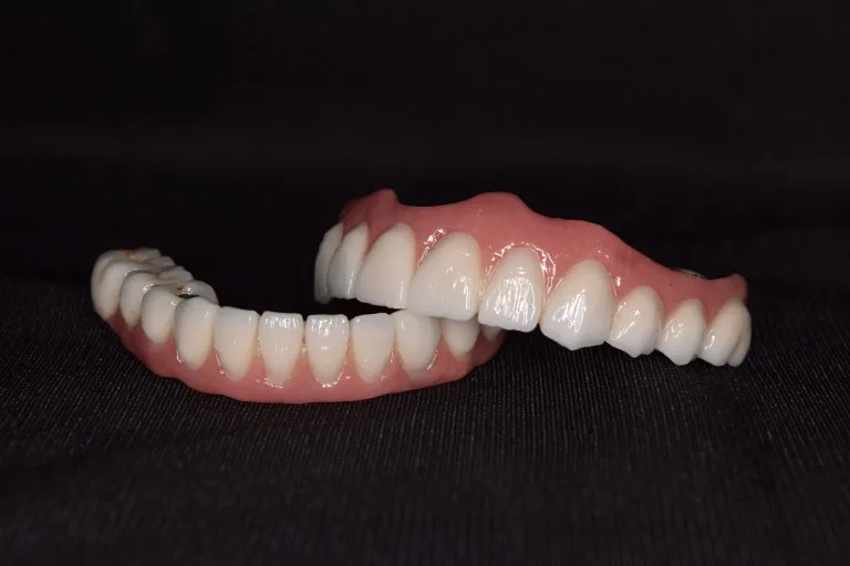 Full Mouth Rehabilitation Procedure Case 7 Nijanand Dental Clinic Jamnagar