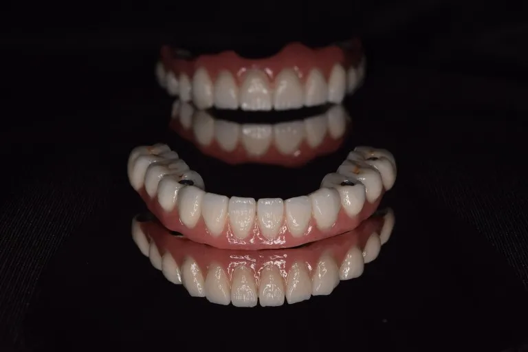 Full Mouth Rehabilitation Transformation Case 8 Nijanand Dental Clinic Jamnagar